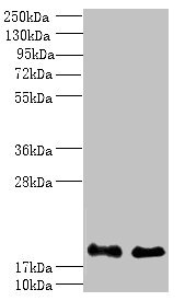 PPP3R1 / Calcineurin B Antibody - Western blot All lanes: PPP3R1 antibody at 1µg/ml Lane 1: K562 whole cell lysate Lane 2: Hela whole cell lysate Secondary Goat polyclonal to rabbit IgG at 1/10000 dilution Predicted band size: 20 kDa Observed band size: 20 kDa