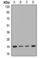 PPP3R1 / Calcineurin B Antibody