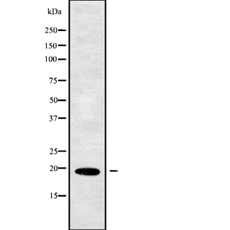 PPP3R1 / Calcineurin B Antibody - Western blot analysis of PPP3R1 using MCF-7 whole cells lysates