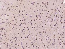 PPP3R1 / Calcineurin B Antibody - Immunochemical staining PPP3R1 in human brain with rabbit polyclonal antibody at 1:200 dilution, formalin-fixed paraffin embedded sections.