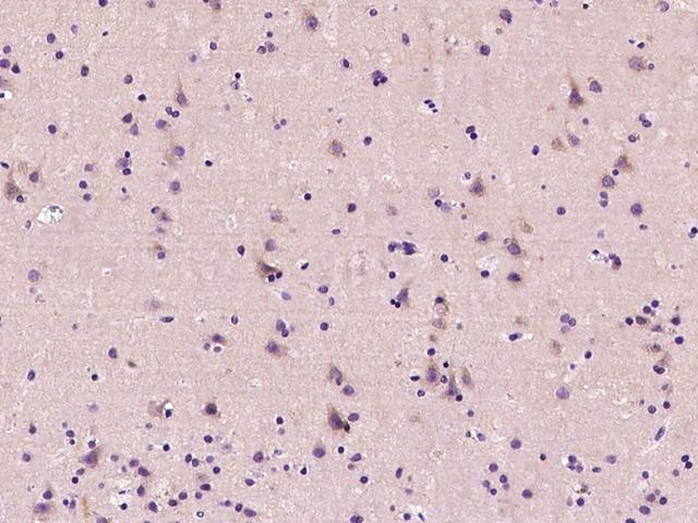 PPP3R1 / Calcineurin B Antibody - Immunochemical staining PPP3R1 in mouse brain with rabbit polyclonal antibody at 1:200 dilution, formalin-fixed paraffin embedded sections.