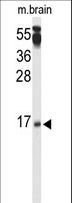 PPP3R2 Antibody - Western blot of PPP3R2 Antibody in mouse brain tissue lysates (35 ug/lane). PPP3R2 (arrow) was detected using the purified antibody.