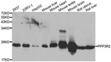 PPP3R2 Antibody - Western blot analysis of extracts of various cell lines.