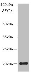 PPP3R2 Antibody - Western blot All Lanes: PPP3R2 antibody at 9.25ug/ml+ Mouse brain tissue Goat polyclonal to rabbit at 1/10000 dilution Predicted band size: 20 kDa Observed band size: 20 kDa