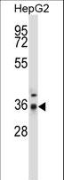 PPP4C Antibody - PPP4C Antibody western blot of HepG2 cell line lysates (35 ug/lane). The PPP4C antibody detected the PPP4C protein (arrow).