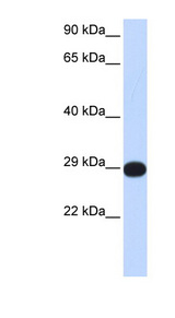 PPP4C Antibody - PPP4C antibody Western blot of Fetal Muscle lysate. This image was taken for the unconjugated form of this product. Other forms have not been tested.