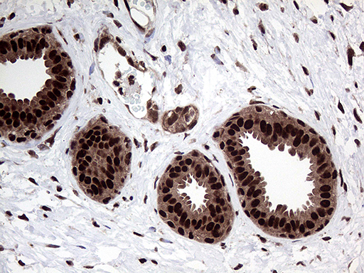 PPP4C Antibody - Immunohistochemical staining of paraffin-embedded Human breast tissue within the normal limits using anti-PPP4C mouse monoclonal antibody. (Heat-induced epitope retrieval by 1mM EDTA in 10mM Tris buffer. (pH8.5) at 120°C for 3 min. (1:2000)