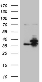 PPP4C Antibody - HEK293T cells were transfected with the pCMV6-ENTRY control. (Left lane) or pCMV6-ENTRY PPP4C. (Right lane) cDNA for 48 hrs and lysed. Equivalent amounts of cell lysates. (5 ug per lane) were separated by SDS-PAGE and immunoblotted with anti-PPP4C. (1:2000)