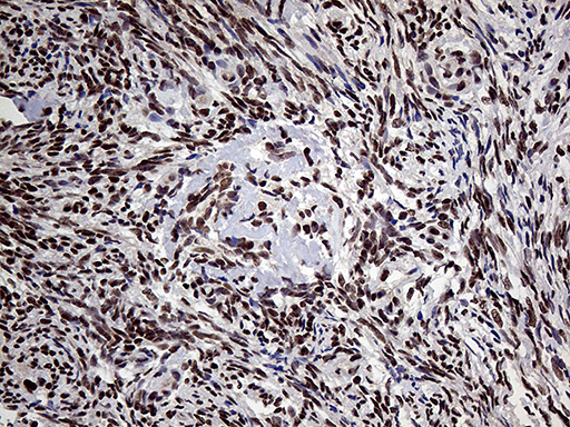 PPP4C Antibody - Immunohistochemical staining of paraffin-embedded Human Ovary tissue within the normal limits using anti-PPP4C mouse monoclonal antibody. (Heat-induced epitope retrieval by 1mM EDTA in 10mM Tris buffer. (pH8.5) at 120°C for 3 min. (1:2000)