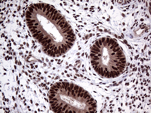 PPP4C Antibody - Immunohistochemical staining of paraffin-embedded Human endometrium tissue within the normal limits using anti-PPP4C mouse monoclonal antibody. (Heat-induced epitope retrieval by 1mM EDTA in 10mM Tris buffer. (pH8.5) at 120°C for 3 min. (1:2000)