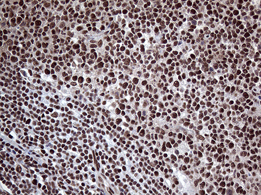 PPP4C Antibody - Immunohistochemical staining of paraffin-embedded Human lymph node tissue within the normal limits using anti-PPP4C mouse monoclonal antibody. (Heat-induced epitope retrieval by 1mM EDTA in 10mM Tris buffer. (pH8.5) at 120°C for 3 min. (1:2000)