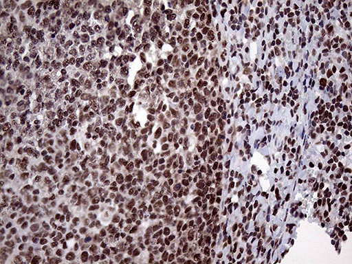PPP4C Antibody - Immunohistochemical staining of paraffin-embedded Human tonsil within the normal limits using anti-PPP4C mouse monoclonal antibody. (Heat-induced epitope retrieval by 1mM EDTA in 10mM Tris buffer. (pH8.5) at 120°C for 3 min. (1:2000)