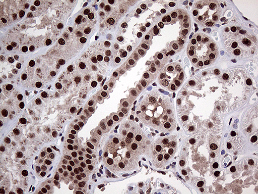 PPP4C Antibody - Immunohistochemical staining of paraffin-embedded Human Kidney tissue within the normal limits using anti-PPP4C mouse monoclonal antibody. (Heat-induced epitope retrieval by 1mM EDTA in 10mM Tris buffer. (pH8.5) at 120°C for 3 min. (1:2000)