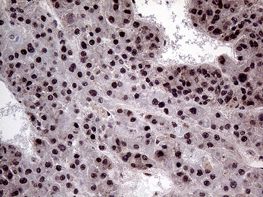 PPP4C Antibody - Immunohistochemical staining of paraffin-embedded Human liver tissue within the normal limits using anti-PPP4C mouse monoclonal antibody. (Heat-induced epitope retrieval by 1mM EDTA in 10mM Tris buffer. (pH8.5) at 120°C for 3 min. (1:2000)