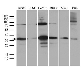 PPP4C Antibody - Western blot analysis of extracts. (35ug) from 6 different cell lines by using anti-PPP4C monoclonal antibody. (1:500)