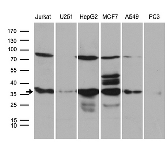 PPP4C Antibody - Western blot analysis of extracts. (35ug) from 6 different cell lines by using anti-PPP4C monoclonal antibody. (1:500)