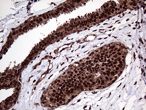 PPP4C Antibody - Immunohistochemical staining of paraffin-embedded Human breast tissue within the normal limits using anti-PPP4C mouse monoclonal antibody. (Heat-induced epitope retrieval by 1mM EDTA in 10mM Tris buffer. (pH8.5) at 120°C for 3 min. (1:2000)