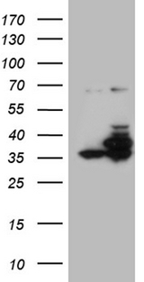 PPP4C Antibody - HEK293T cells were transfected with the pCMV6-ENTRY control. (Left lane) or pCMV6-ENTRY PPP4C. (Right lane) cDNA for 48 hrs and lysed. Equivalent amounts of cell lysates. (5 ug per lane) were separated by SDS-PAGE and immunoblotted with anti-PPP4C. (1:2000)