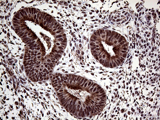 PPP4C Antibody - Immunohistochemical staining of paraffin-embedded Human endometrium tissue within the normal limits using anti-PPP4C mouse monoclonal antibody. (Heat-induced epitope retrieval by 1mM EDTA in 10mM Tris buffer. (pH8.5) at 120°C for 3 min. (1:2000)