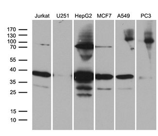 PPP4C Antibody - Western blot analysis of extracts. (35ug) from 6 different cell lines by using anti-PPP4C monoclonal antibody. (1:500)