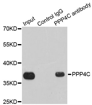 PPP4C Antibody - Immunoprecipitation analysis of 200ug extracts of 293T cells.