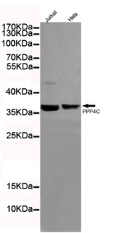 PPP4C Antibody - Western blot detection of Protein Phosphatase 4C in HeLa and Jurkat cell lysates using Protein Phosphatase 4C mouse monoclonal antibody (1:200 dilution). Predicted band size: 34KDa. Observed band size: 34KDa.