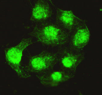 PPP4C Antibody - Immunocytochemistry of HeLa cells using anti-Protein Phosphatase 4C mouse monoclonal antibody diluted 1:200.