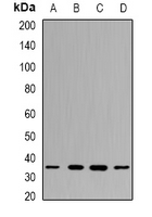 PPP4C Antibody - Western blot analysis of PPX expression in MCF7 (A); NIH3T3 (B); mouse testis (C); mouse spleen (D) whole cell lysates.