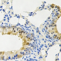 PPP4C Antibody - Immunohistochemical analysis of PPX staining in rat lung formalin fixed paraffin embedded tissue section. The section was pre-treated using heat mediated antigen retrieval with sodium citrate buffer (pH 6.0). The section was then incubated with the antibody at room temperature and detected using an HRP conjugated compact polymer system. DAB was used as the chromogen. The section was then counterstained with hematoxylin and mounted with DPX.