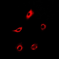 PPP4C Antibody - Immunofluorescent analysis of PPX staining in MCF7 cells. Formalin-fixed cells were permeabilized with 0.1% Triton X-100 in TBS for 5-10 minutes and blocked with 3% BSA-PBS for 30 minutes at room temperature. Cells were probed with the primary antibody in 3% BSA-PBS and incubated overnight at 4 deg C in a humidified chamber. Cells were washed with PBST and incubated with a DyLight 594-conjugated secondary antibody (red) in PBS at room temperature in the dark.