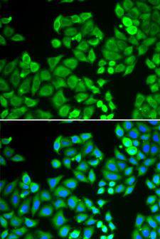 PPP4C Antibody - Immunofluorescence analysis of U2OS cells using PPP4C antibody. Blue: DAPI for nuclear staining.