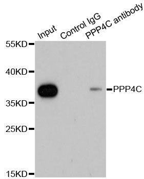 PPP4C Antibody - Immunoprecipitation analysis of 200ug extracts of 293T cells using 1ug PPP4C antibody. Western blot was performed from the immunoprecipitate using PPP4C antibody at a dilition of 1:1000.