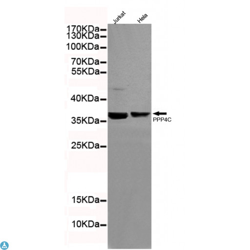 PPP4C Antibody - Western blot detection of Protein Phosphatase 4C in Hela and Jurkat cell lysates using Protein Phosphatase 4C mouse mAb (1:200 diluted). Predicted band size: 34KDa. Observed band size: 34KDa.