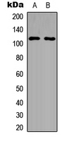 PPP4R1 / PP4R1 Antibody - Western blot analysis of PPP4R1 expression in HEK293T (A); MCF7 (B) whole cell lysates.