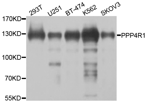 PPP4R1 / PP4R1 Antibody - Western blot analysis of extracts of various cell lines.
