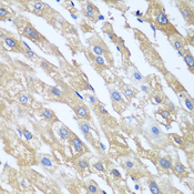 PPP4R1 / PP4R1 Antibody - Immunohistochemistry of paraffin-embedded human liver tissue.