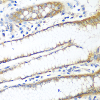 PPP4R1 / PP4R1 Antibody - Immunohistochemistry of paraffin-embedded human stomach tissue.