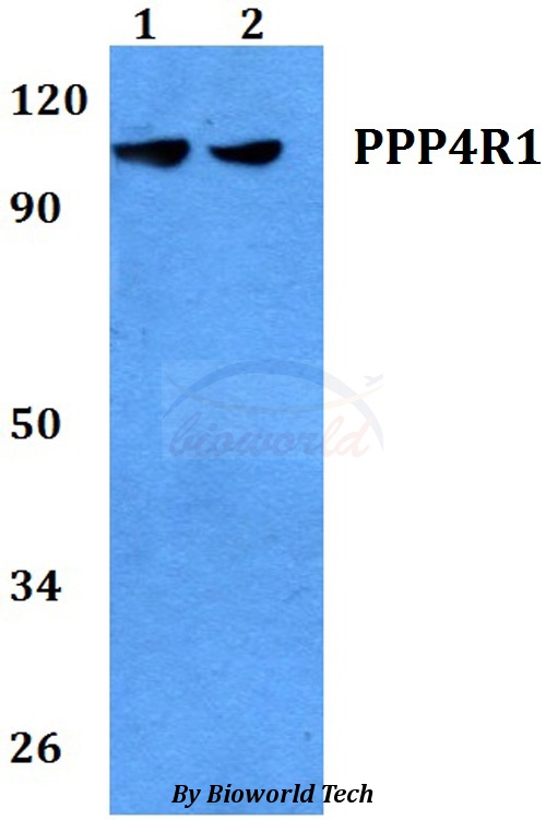 PPP4R1 / PP4R1 Antibody - Western blot of PPP4R1 antibody at 1:500 dilution. Lane 1: HEK293T whole cell lysate. Lane 2: MCF-7 whole cell lysate.