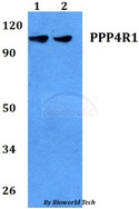 PPP4R1 / PP4R1 Antibody - Western blot of PPP4R1 antibody at 1:500 dilution. Lane 1: HEK293T whole cell lysate. Lane 2: MCF-7 whole cell lysate.