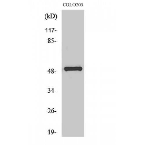 PPP4R1L Antibody - Western blot of PPP4R1L antibody
