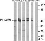 PPP4R1L Antibody - Western blot analysis of lysates from COLO, HUVEC, HepG2, Jurkat, and COS cells, using PPP4R1L Antibody. The lane on the right is blocked with the synthesized peptide.