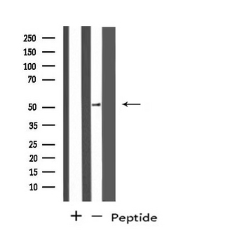 PPP4R1L Antibody - Western blot analysis of extracts of HepG2 cells using PPP4R1L antibody.