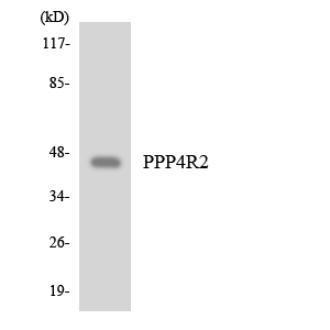 PPP4R2 Antibody - Western blot analysis of the lysates from COLO205 cells using PPP4R2 antibody.