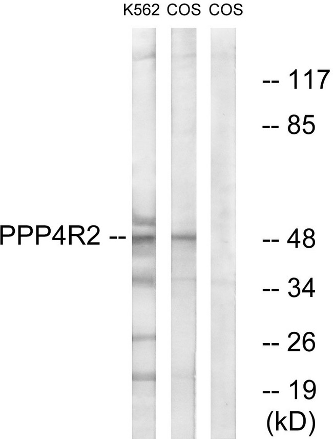 PPP4R2 Antibody - Western blot analysis of lysates from K562 and COS7 cells, using PPP4R2 Antibody. The lane on the right is blocked with the synthesized peptide.