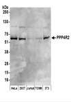 PPP4R2 Antibody - Detection of Human and Mouse PPP4R2 by Western Blot. Samples: Whole cell lysate (50 ug) prepared using NETN buffer from HeLa, 293T, Jurkat, mouse TCMK-1, and mouse NIH3T3 cells. Antibodies: Affinity purified rabbit anti-PPP4R2 antibody used for WB at 0.2 ug/ml. Detection: Chemiluminescence with an exposure time of 75 seconds.