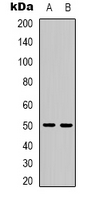 PPP4R2 Antibody - Western blot analysis of PPP4R2 expression in HeLa (A); COS7 (B) whole cell lysates.