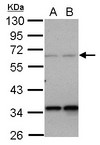 PPP4R2 Antibody - Sample (30 ug of whole cell lysate) A: A431 B: Jurkat 10% SDS PAGE PPP4R2 antibody diluted at 1:1000
