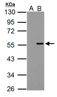 PPP4R2 Antibody - Sample (30 ug of whole cell lysate) A: Non-transfected 293T lysates B: PPP4R2 transfected 293T lysate 10% SDS PAGE PPP4R2 antibody diluted at 1:5000