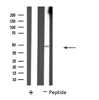 PPP4R2 Antibody - Western blot analysis of extracts of K562 cells using PP4R2 antibody.