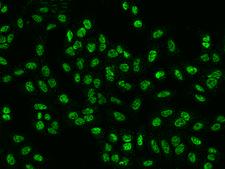 PPP4R2 Antibody - Immunofluorescence staining of PPP4R2 in U2OS cells. Cells were fixed with 4% PFA, permeabilzed with 0.1% Triton X-100 in PBS, blocked with 10% serum, and incubated with rabbit anti-human PPP4R2 polyclonal antibody (dilution ratio 1:1000) at 4°C overnight. Then cells were stained with the Alexa Fluor 488-conjugated Goat Anti-rabbit IgG secondary antibody (green). Positive staining was localized to Nucleus.